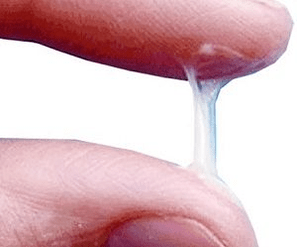 Miltä miehen erite näyttää normaalisti